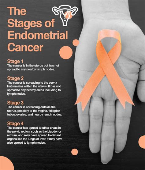 endometrial cancer stages 1-4